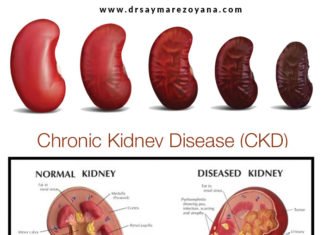 কিডনি রোগের কারণ ও কিডনি সুস্থ রাখার পরামর্শ