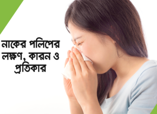 নাকের পলিপের লক্ষণ, কারন ও প্রতিকার