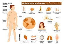 The Impact of Autoimmune Diseases on Daily Life: Tips for Managing Symptoms Autoimmune Diseases