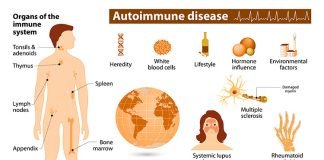 Autoimmune Diseases