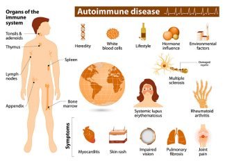 The Impact of Autoimmune Diseases on Daily Life: Tips for Managing Symptoms Autoimmune Diseases